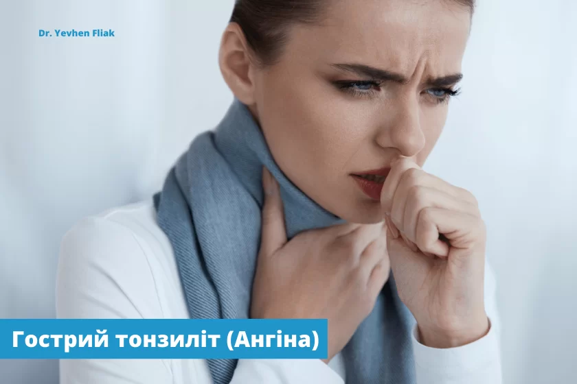gostrij-tonzilit_2